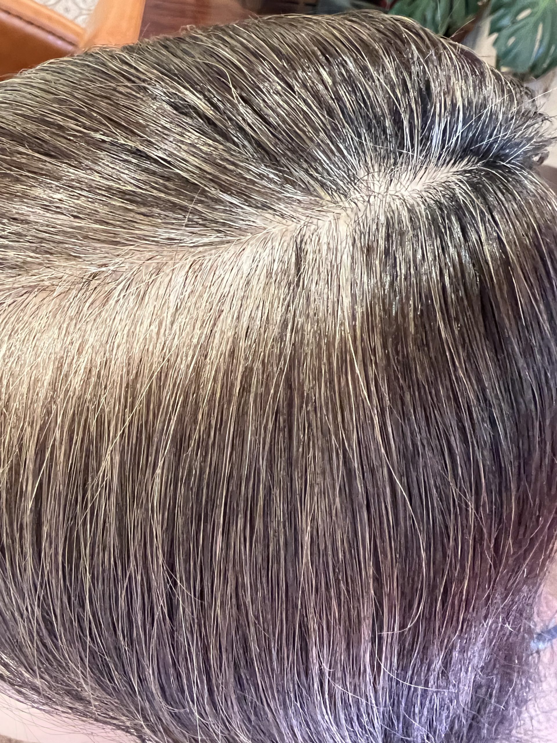 白髪減少効果✖️高発生医療水素